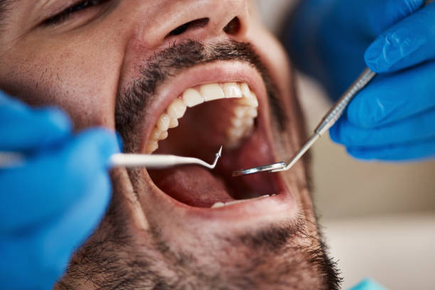 Best Same-Day Emergency Dental Services in Mckinley, PA